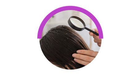 Anti Dandruff Treatment