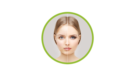 Anti-Ageing Treatments