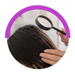 Is dandruff curable?