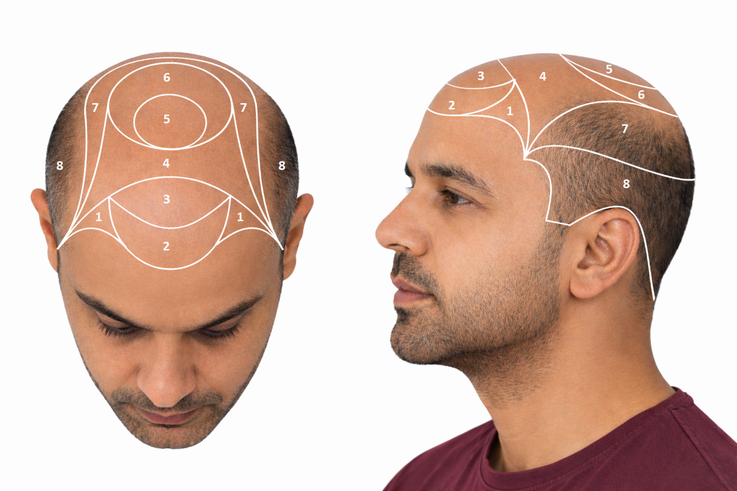 Scalp diagram