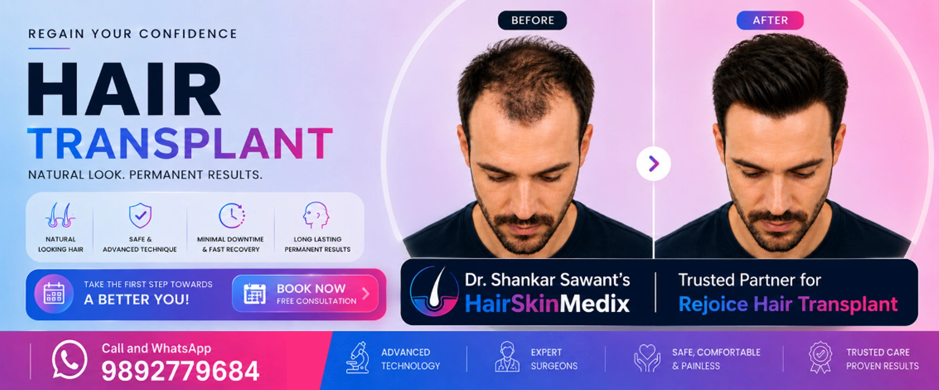Hair Transplant